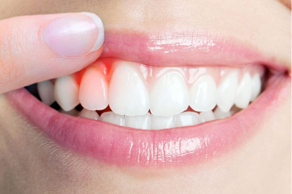 Diş-Eti-Hastaliklari-1024x682